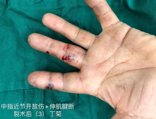 640.webp (5).png