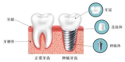 640.webp (1).png