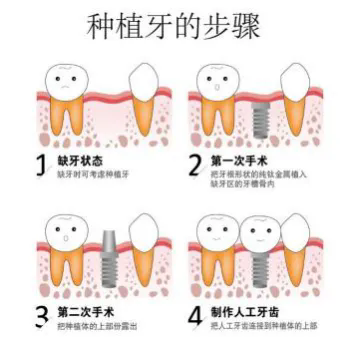 640.webp (2).png